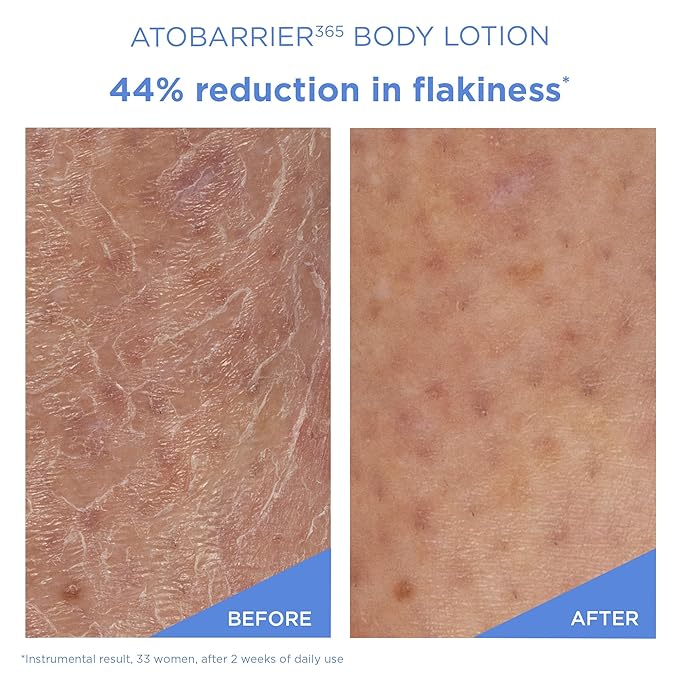 AESTURA ATOBARRIER365 Korean Body Lotion with Ceramides & Glycerin | Lightweight Hydrating Moisturizer for Dry, Sensitive & Eczema-Prone Skin | Fragrance-Free | Korean Skin Care, 400 mL / 13.5 fl oz