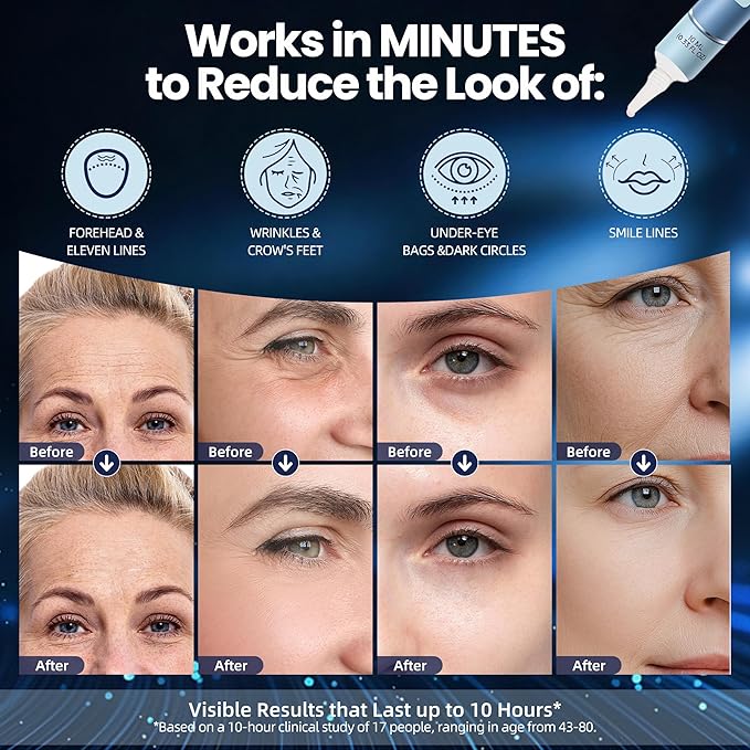KKP Rapid Reduction Eye Serum - Visibly Reduces Under-Eye Bags, Wrinkles, Dark Circles, Fine Lines & Crow's Feet Instantly, Anti Aging Wrinkle Remover for Face, 3 Full Size Tubes