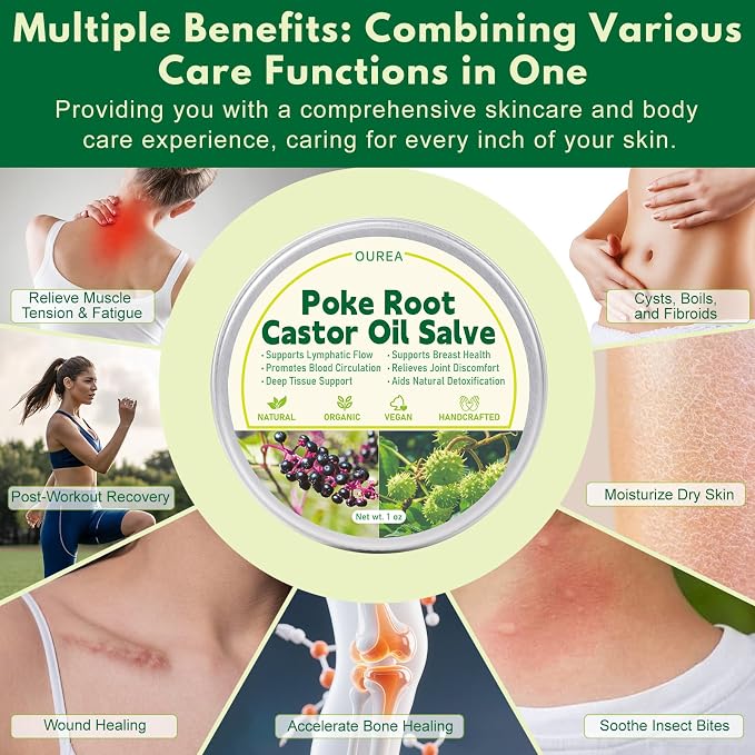 Poke Root Castor Oil Salve, Organic Lymphatic Support Massage Balm, Deep Tissue Ointment for Cyst, Boils, Breast, Fibroids, Swollen Lymph Nodes & Joint, Natural, Vegan - 1 Oz