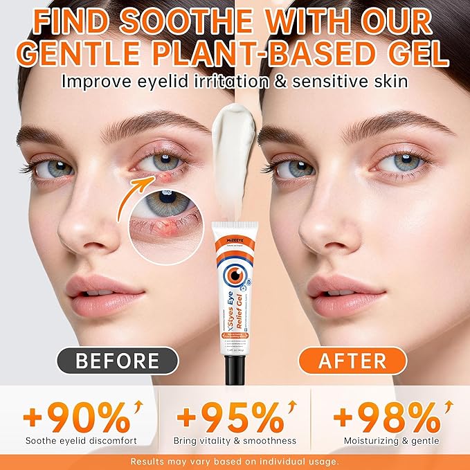 Styes Eye Relief Gel For Blepharitis & Chalazion, Eye Cream With Avocado, Sea Buckthorn & Grape Seed Oils, Soothing Irritation, Puffiness, Dark Circles, Chalazion Remover, 40g/1.4 fl oz