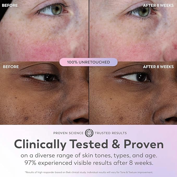 Olay Super Serum - Glow Serum for Face - Activated Niacinamide, Vitamin C & E, Collagen Peptide, AHA - 5-in-1 Benefits - Brightens, Hydrates, Smooths, Firms, Evens Tone, Proactive Anti-Aging, 1.7 Oz