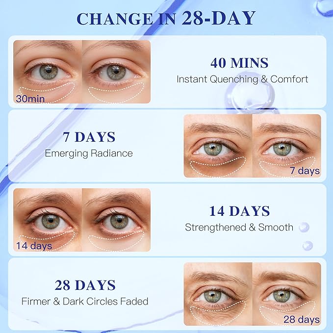 Blueberry Collagen Under Eye Patches, Eye Mask for Puffy Eyes and Dark Circles, Deep Hydrating Under Eye Mask Patches for Eye Bags Treatment, Under-eye Skincare for Dullness (12 pairs)