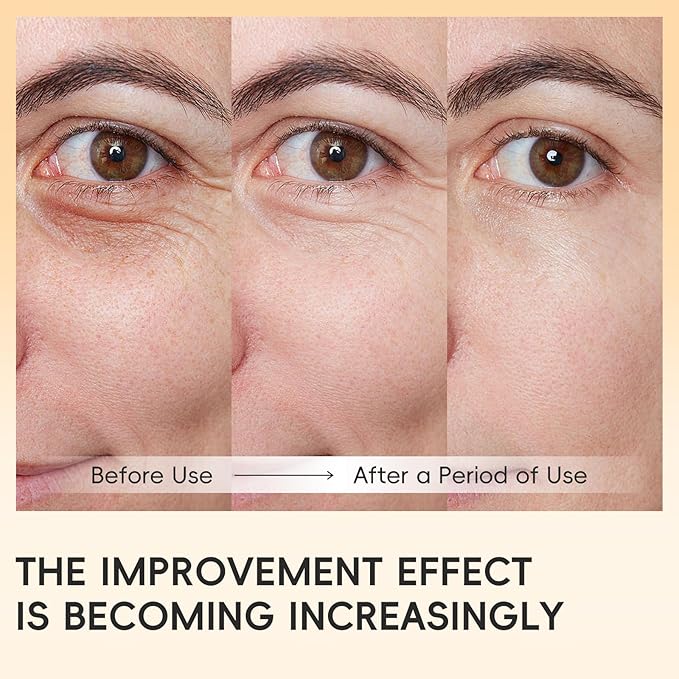 AKARY Dual Vitamin C Eye Cream, Hydrating Under Eyes Cream for Dark Circles and Puffiness with Triple-Roller Massage Ball Reduce Bags, Wrinkles and Fine Lines Eye Bags Treatment for Men/Women
