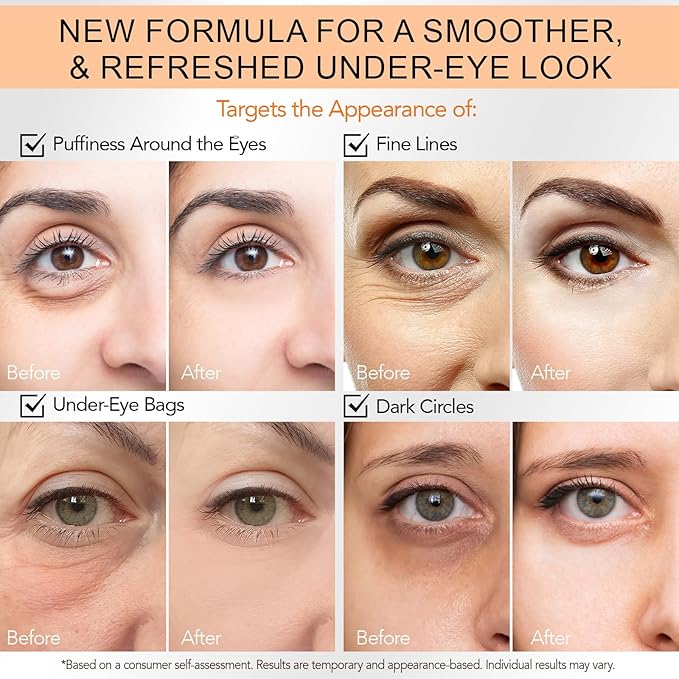 Instant Eye Tightener Cream, Under Eye Cream, Eye Cream for Puffiness and Bags Under Eyes, Retinol Eye Cream Anti Aging, Instantly Tightens and Smooths Dark Circles and Wrinkles for Men and Women 30ml