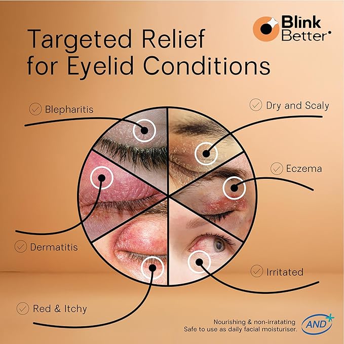 BlinkBetter BetterLids Restore Eyelid Cream – Barrier Support to Hydrate, Soothe & Moisturise Dry, Itchy, Red & Sensitive Eyelids – Lightweight Daily Formula with 3% Oat & Ceramides, 1 fl oz