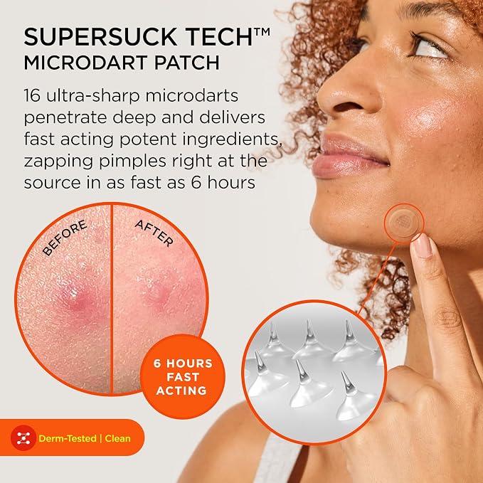 ZitSticka Killa Microdart Pimple Patches for Face - Most Potent Pimple Patch with Fast-Acting Microdarts - For Deep, Early-Stage Zits with Salicylic Acid - Mini 4 Count