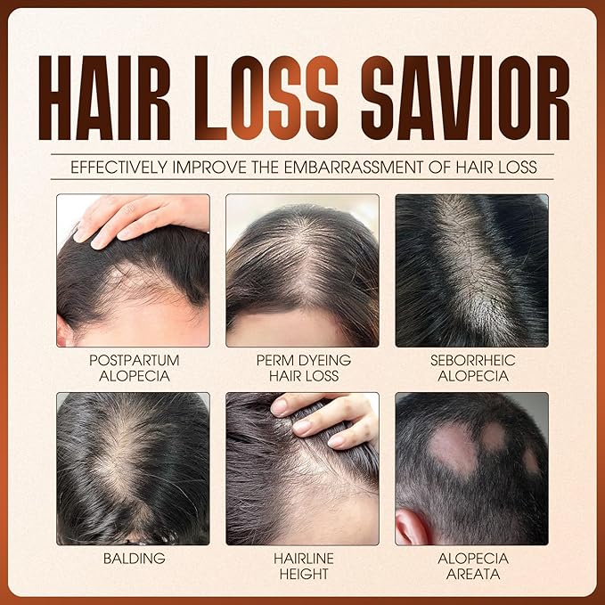 Hair Growth Spray, Hair Growth Oil Spray, With Biotin, Ginger Root Extract, He Shou Wu, Castor Oil, Reduced Shedding, Hydration and Silky Texture for Women & Men - 50ml (1)