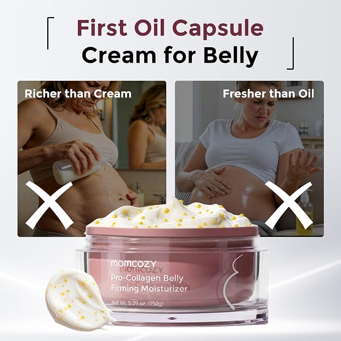 Momcozy Stretch Mark Cream, EWG Verified & Dermatologist Tested, 4x Peptide & Centella Oil Capsule Belly Moisturizer for Pregnancy, Nourishes Dry Skin, 5.29 oz (150g)