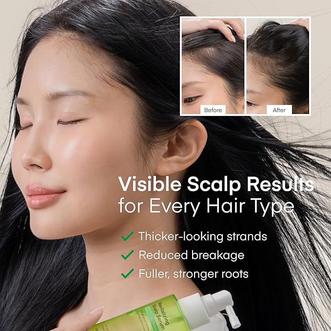 Scalp Serum for Hair Growth Spray - Korean Vegan Treatment for Hair Loss, Thinning & Itchy Scalp, Dermatologically-Tested, Lightweight Exfoliates Dandruff, Strengthen Roots for Men & Women - 2 Pack
