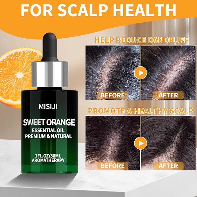 Sweet Orange Essential Oils-1 FL.OZ-Essential Oils for Diffuser for Home,Diffuser Oils Scents for Aromatherapy,Laundry,Candle&Soap Making,Humidifiers