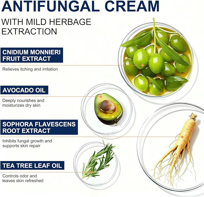 Antifungal Cream for Jock Itch, Athletes Foot & Ringworm - 2% Miconazole Nitrate Cream for Humans Skin Fungus, Relieves Itching, Burning, Cracking and Scaling (3.5 Ounce)