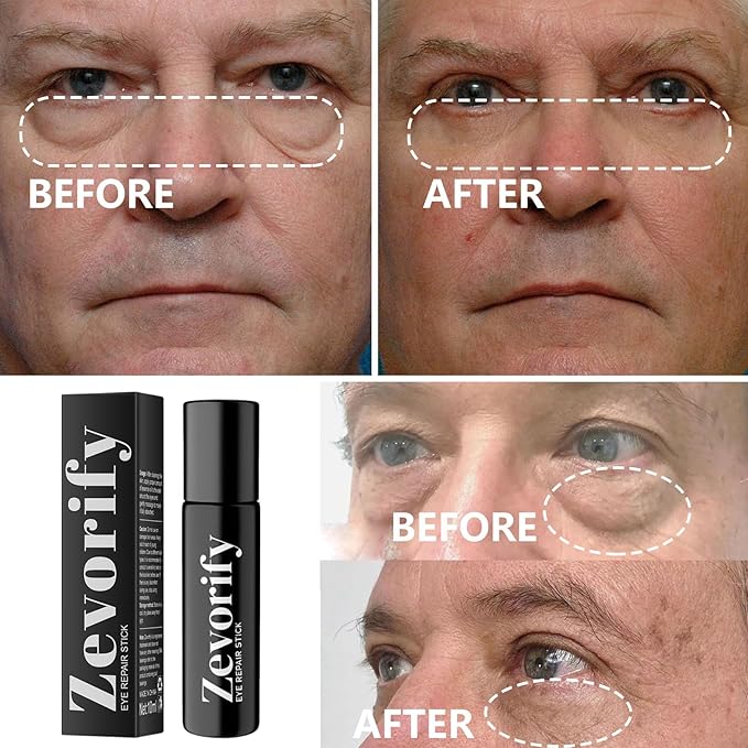 Eye Repair Stick for Men | 2PCS Caffeine Under Eye Roller for Eyebags and Dark Circles - Cooling Stick Hydrates and Depuffing, 0.34 Fl Oz (2 PCS, 0.34 Fl Oz/PC)
