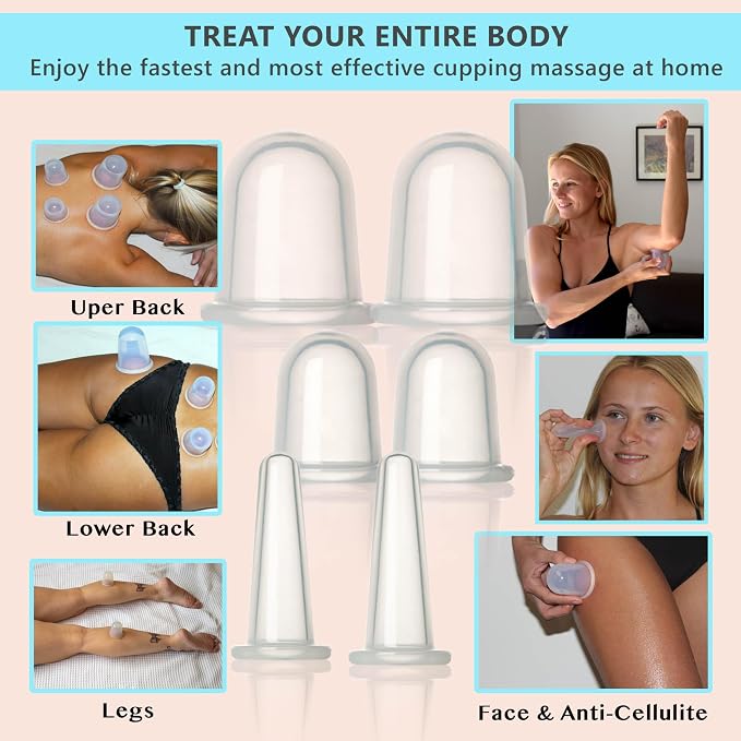 Cupping Kit for Massage Therapy, Set of 6 Professional Silicone Cups
