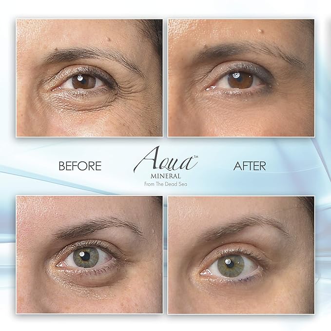 Puffy Eye GEL Instant results – Naturally rapid reduction eye gel, Eliminate Wrinkles, Puffiness and Bags – Hydrating Eye Gel w/Green Tea Extract by Aqua Mineral – 1 oz