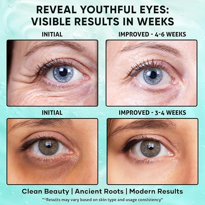 Bakuchiol, Caffeine Under Eye Milky Serum for Dark Circles, Puffiness & Fine Lines with Peptides & Ectoin - Brightening & Hydrating Lightweight Plant-Based Vegan Eye Cream 15ml