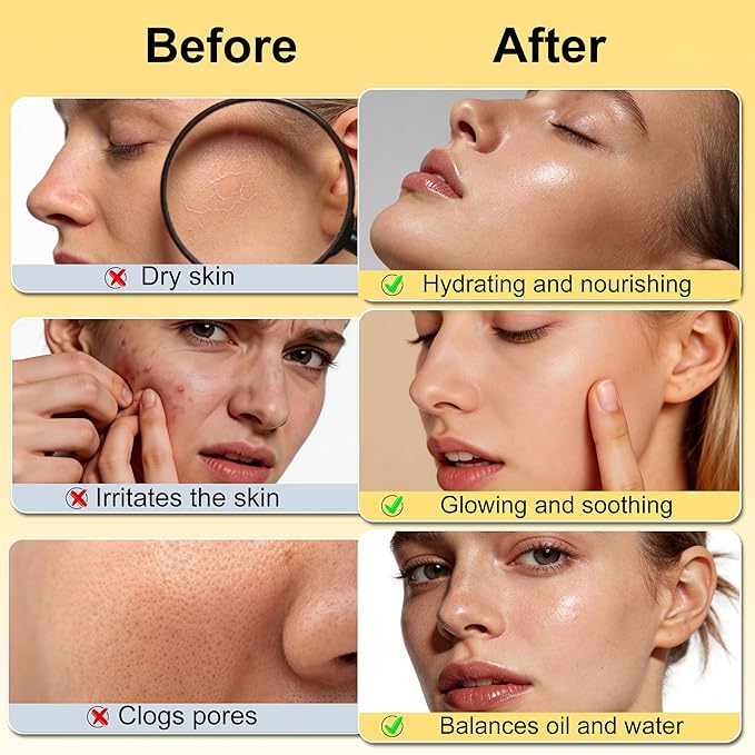 Skin Care Set w/Korean Rice Extract for Hydration,Glow,Repair &Radiant Skin | 6Pcs Women Teen Glass Skincare Routine Kit Self Care Gifts for Women Mom Wife Teenage Girl Valentines Christmas Gifts