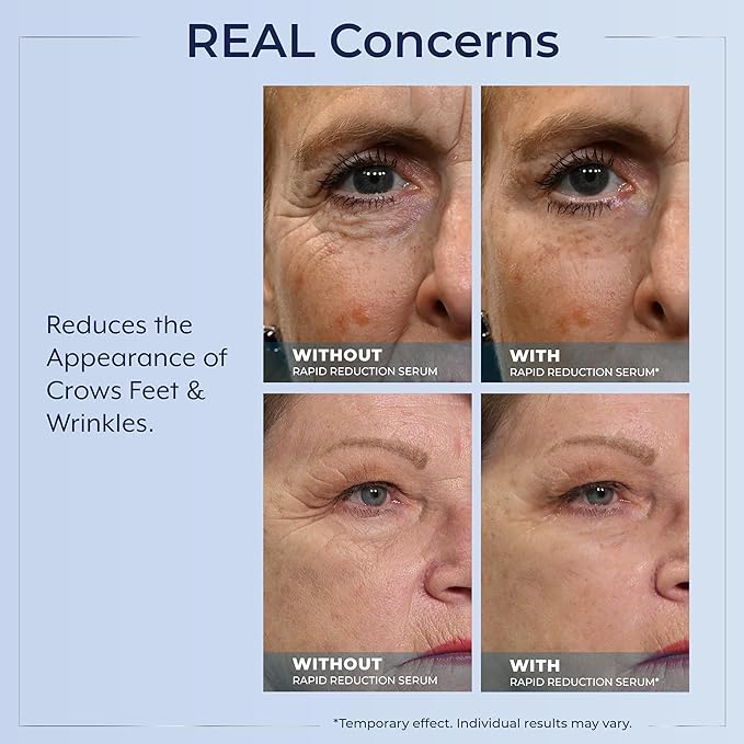 Plexaderm Rapid Reduction Eye Serum - Visibly Reduces Under-Eye Bags, Wrinkles, Dark Circles, Fine Lines & Crow's Feet Instantly, Anti Aging Wrinkle Remover for Face, Full Size Tube