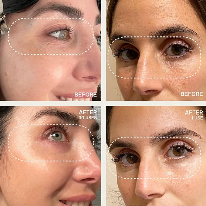 Dermaclara Silicone Patch Eyes & Forehead Kit - Anti-Wrinkle Face Patches for Frown & Smile Lines, Reusable Overnight Silicone Wrinkle Pads, Up to 30 Uses - 4 Eye & Mouth, 1 Forehead