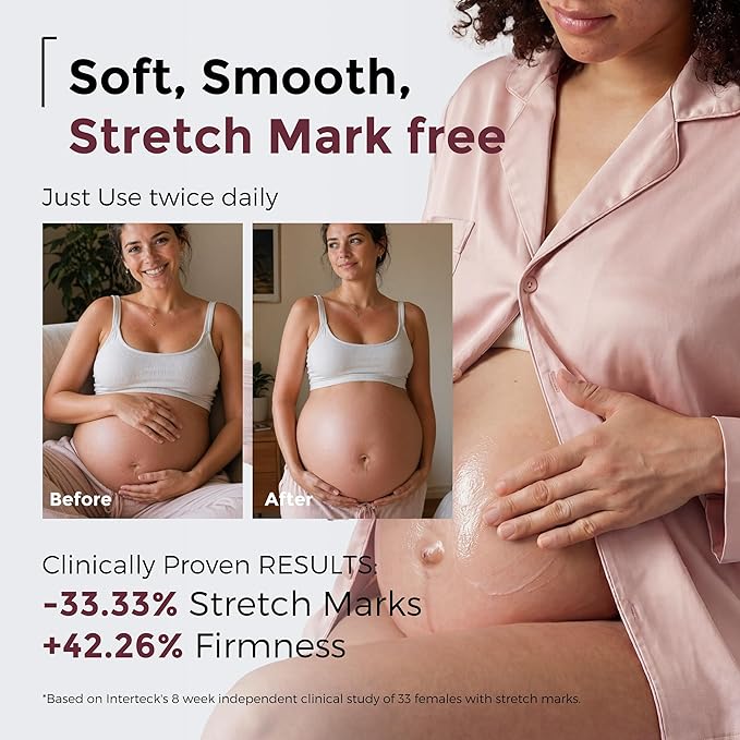Momcozy Stretch Mark Prevention Cream, Travel Size Belly Moisturizer for Dry Skin, Peptides & Shea Butter, EWG Verified, Dermatologist Tested Maternity Care, 1.06 oz (30g)