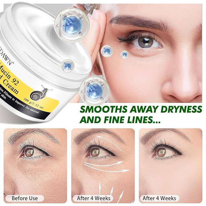 Snail Mucin 92% Repair Cream 100g, Face Moisturizer Hydrating Repair Face Cream for Dry & Sensitive Skin, All Skin Types