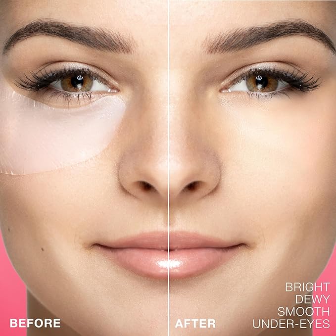 STARSKIN Eye Catcher 2 Pairs, Bio-Cellulose Under Eye Patches, for Dark Circles, Wrinkles, Eye Bags & Puffy Eyes, Brightening & Refining Under Eye Treatment, Korean Skincare