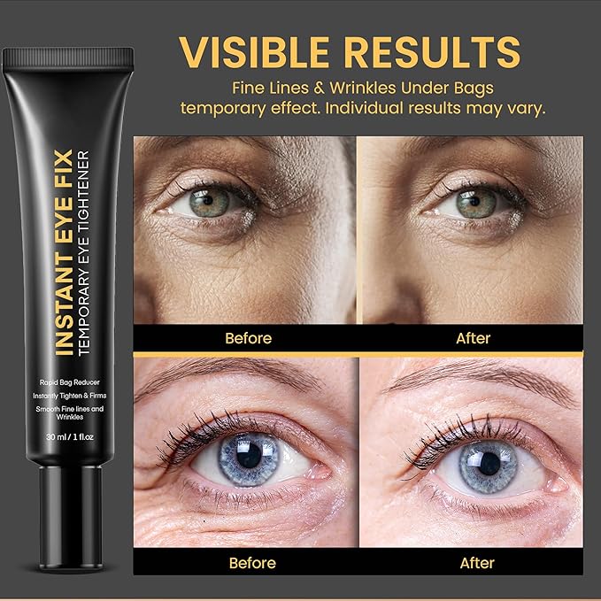 Temporary Instant Under Eye Tightener: Reduces Under-Eye Bags, Dark Circles, Puffiness, Wrinkles Advanced Firming Polysaccharide Formula 30 ml