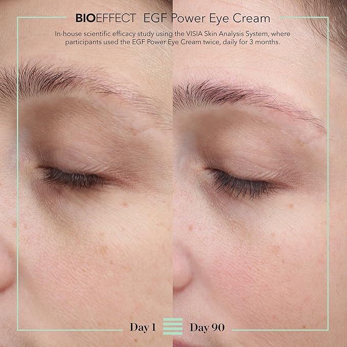 BIOEFFECT EGF Power Eye Cream | Intensive Age-Defying Eye Treatment with Epidermal Growth Factor + Bakuchiol + Niacinamide for Wrinkles, Dark Circles & Puffiness | 15 mL / 0.51 oz
