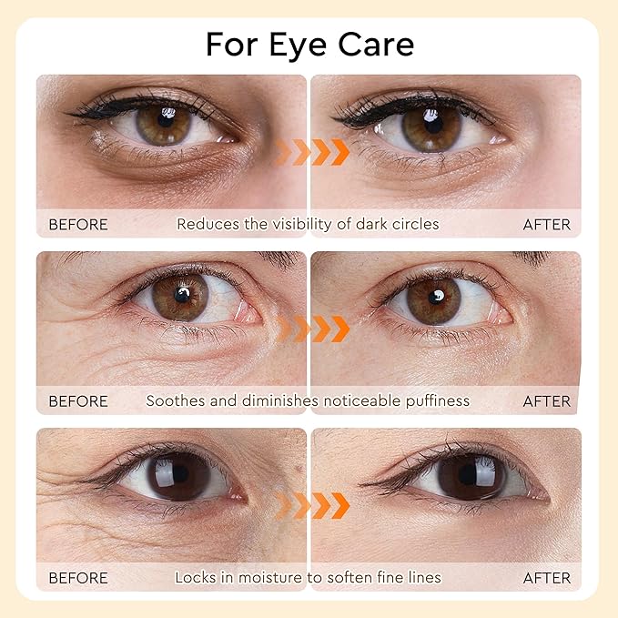 Under Eye Patches for Women Calendula Caffeine Eye Mask for Dark Circles, Puffy Eyes, Undereye Bags, Soothing Brighten Skin Care- Travel Essentials- Bachelorette Party Favors Gift