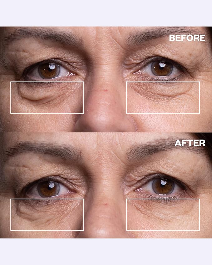 Wrinkles Schminkles Under Eye Wrinkle Starter Pack - Set of Reusable Under Eye Wrinkle Patches (3 pairs) + Silicone Patch Cleanser (2 oz) for Smoother Under Eyes & Fresh Look