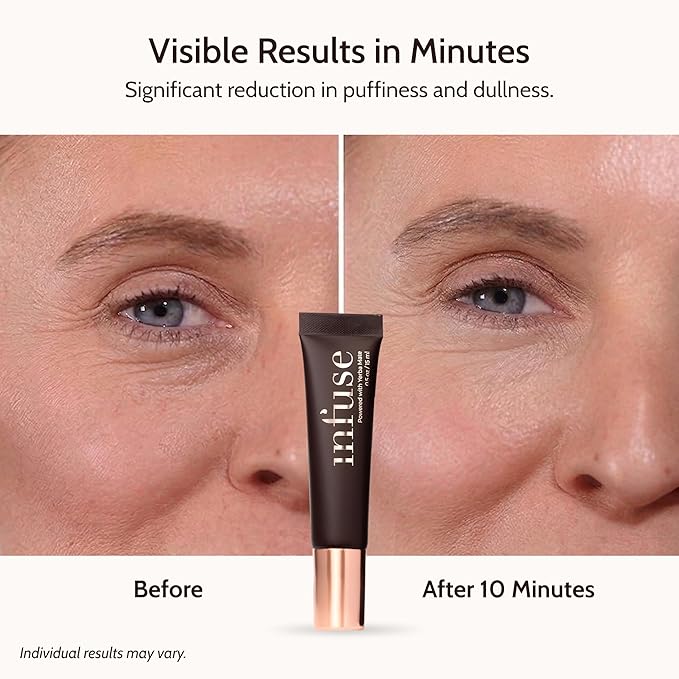 Infuse AWARD WINNER Peptide Eye Cream for Dark Circles, Eye Cream Anti Aging and Hydrating Formula, Eye Cream for Wrinkles Puffiness and Firmness, Revitalizing Eye Repair Cream, 0.5 oz