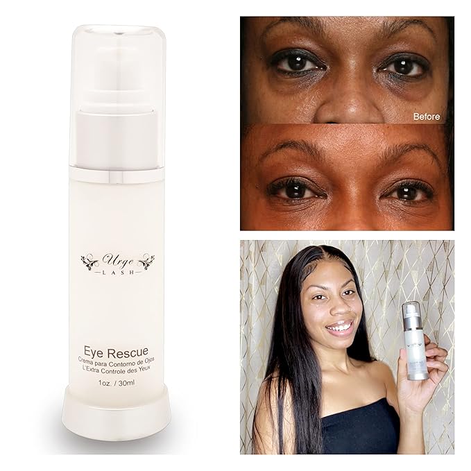 Non Comedogenic Eye Cream - Eye cream anti aging, Puffy Eyes Anti Aging Vitamin C, E & Collagen Shea butter Reduce Dark Circles, Puffiness, Under Eye Bags, Wrinkles & Fine Lines for Men & Women,dark circles under eye treatment for women,eye brightening...