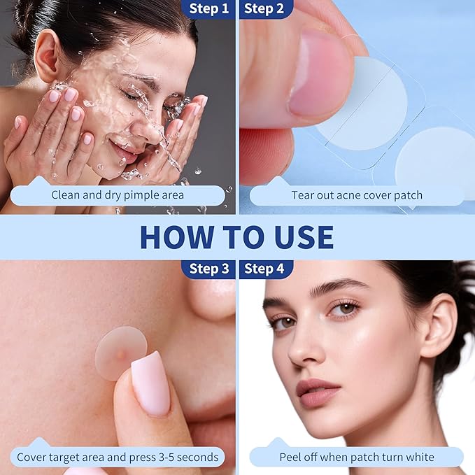 Pimple Patches for Face, 4 Size 360 Counts Hydrocolloid Acne Patches for Covering Zits and Blemishes, Spot Stickers with Salicylic Acid, Tea Tree Oil & Calendula Oil, Mini Package