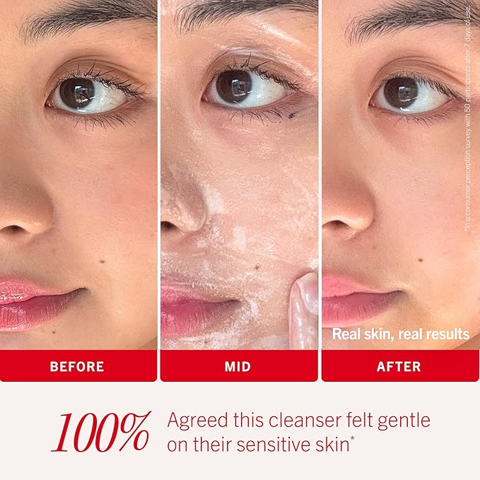 First Aid Beauty Ultra Gentle Cream-to-Foam Pure Facial Cleanser – Makeup Removing Face Cleanser - Face Wash with Colloidal Oatmeal & Glycerin, for Sensitive, Acne & Blemish-Prone Skin, 10 oz