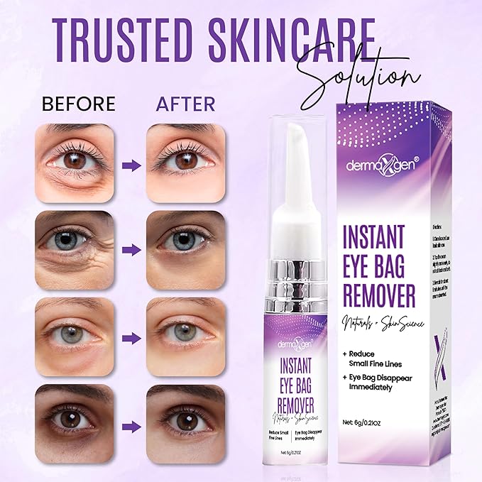 Instant Under Eye Bag Remover Cream - Dark Circles Under Eye Treatment Cream for Wrinkles & Puffiness - Advanced Anti-Aging Formula for Women - Quick Solution for Tired & Dull Skin - 0.21 OZ
