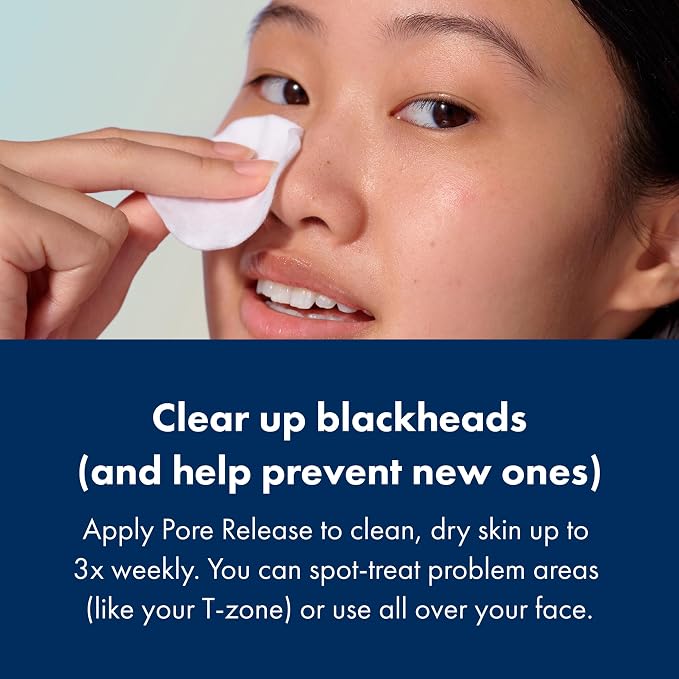 Hero Cosmetics Pore Release Blackhead Clearing Solution, 3.38 Fl Oz | Blackhead Remover Toner; Exfoliating 2% Salicylic Acid Toner Featuring AHA, BHA, and PHA; Acne Treatment
