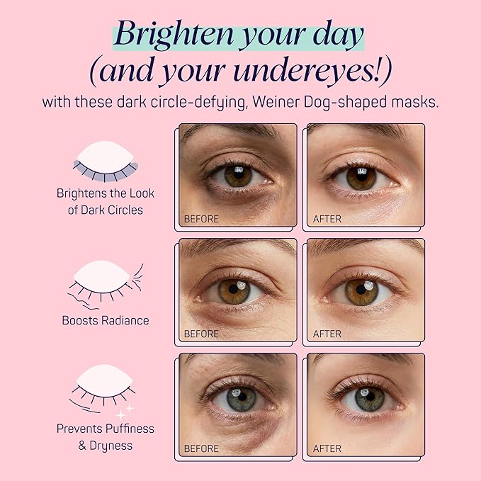 SpaLife So Fetch Hydrogel Under Eye Patches for Dark Circles | Dachshund Under Eye Patches for Puffy Eyes | Weiner Dog Undereye Bags and Puffiness Removal | Pack of 8 Pairs (8 Undereye Treatments)