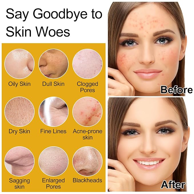 Skin Care Set w/Korean Rice Extract for Hydration,Glow,Repair &Radiant Skin | 7Pcs Women Teen Glass Skincare Routine Kit Self Care Gifts for Women Mom Wife Teenage Girl Valentines Christmas Gifts