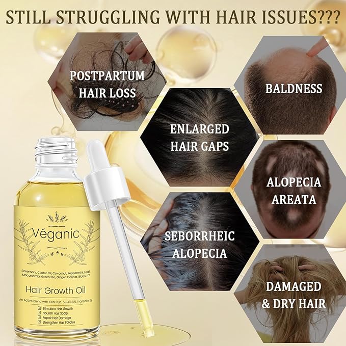 Natural Hair Growth Oil Kit with Rosemary Hair Oils for Hair Growth for Dry Damaged Hair, for Men and Women 2PCS*2 fl.oz (Yellow)