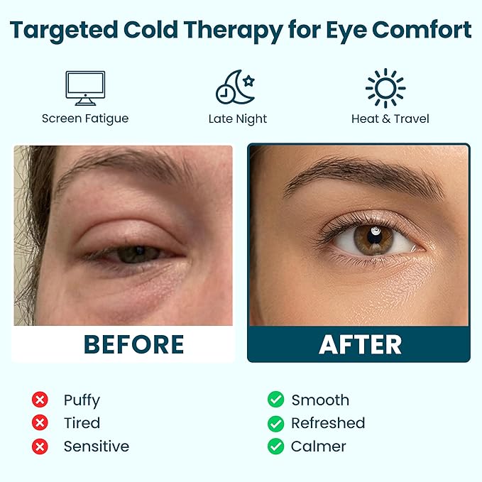 Eye Serenity CHILL Self Cooling Eye Mask for Puffy Under-Eyes, Dark Circles, Hyaluronic Acid Long-Lasting Cold Eye Compress, Mothers Day Gifts, Spa Relaxation and Self-care Gifts for Women & Men