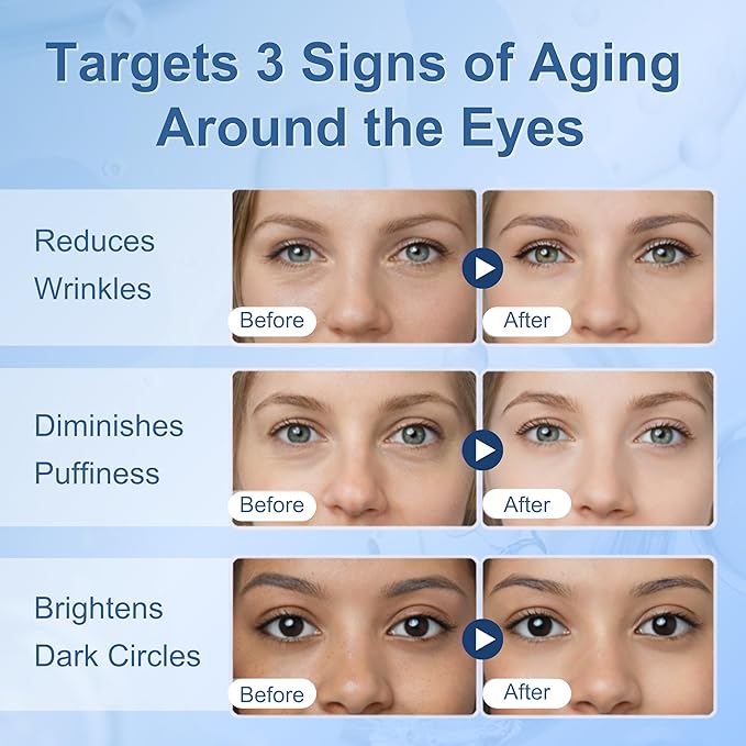 Retinol Eye Cream, Retinol and Peptides for Instant Firming Eye Serum | Fast Absorbing, Correction for Puffy Eye Bags Fine Lines Dark Circles Wrinkles – Anti-Aging Wrinkle Remover