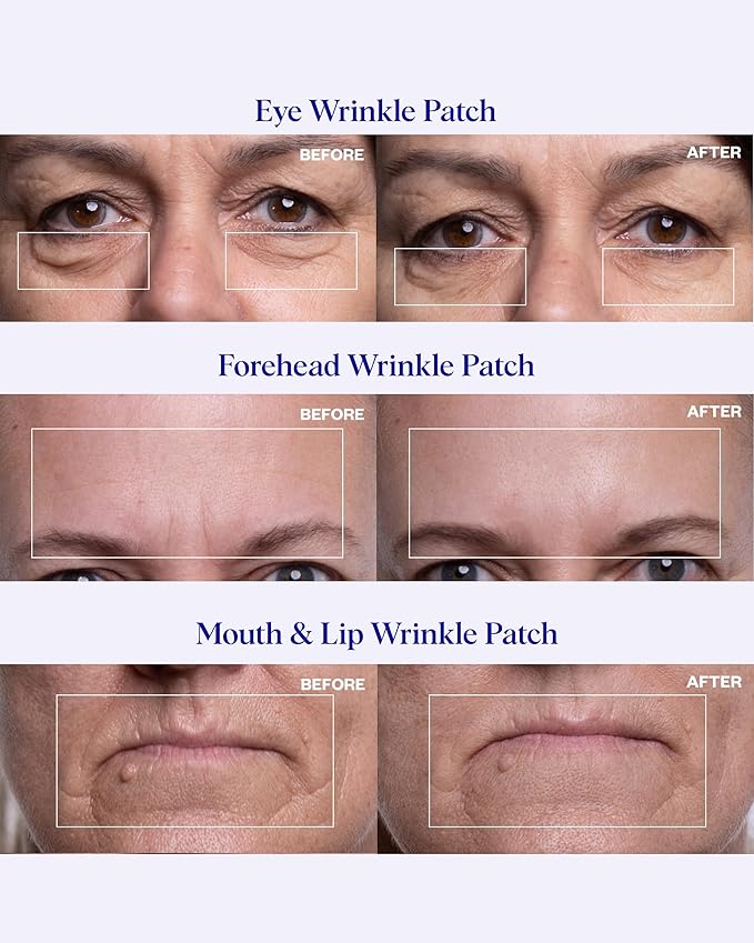 Wrinkles Schminkles Facial Smoothing Set | Mouth & Lip 2-Pack | Eye Wrinkle Patches 3-Pairs | Forehead Wrinkle Patches 2-Pack | Reusable Hypoallergenic Silicone Smoothing Pads
