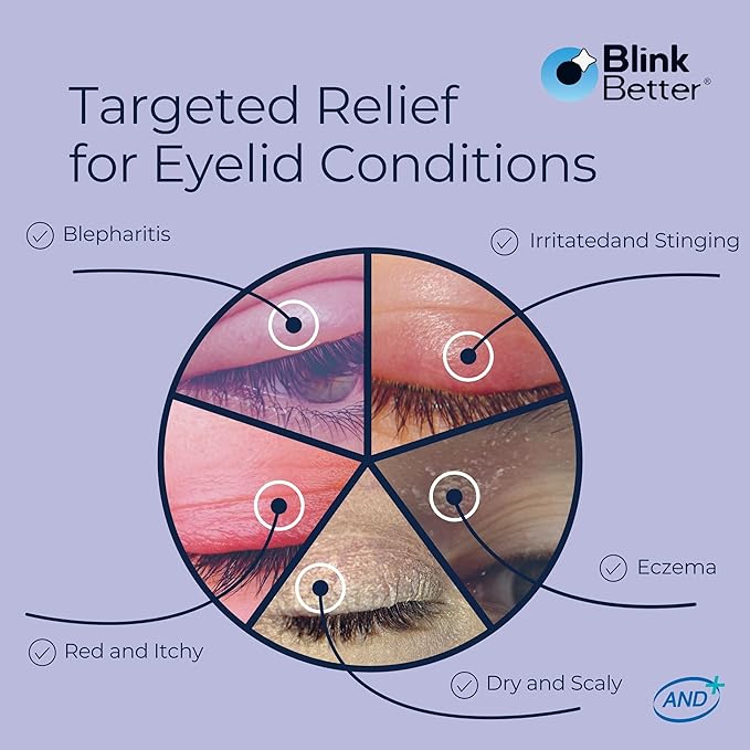 BlinkBetter BetterLids Eyelid Ointment for Dry, Itchy & Sensitive Eyelids – Deep-Moisturising Oat Complex with Shea Butter & Panthenol to Hydrate, Nourish & Soothe Delicate Eyelid Skin – 0.34 oz