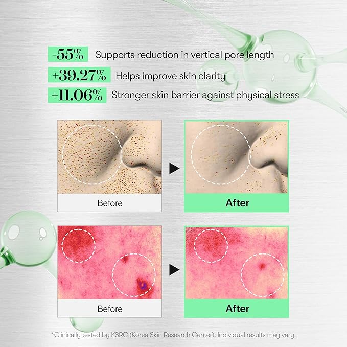 VT COSMETICS CICA Reedle Shot 100, Spicule Microneedling Serum for Pore Care & Exfoliation, Exosome, Centella Asiatica for Glass Skin, Skin Texture, Korean Liquid Skin Booster (1.69 Fl Oz / 50ml)