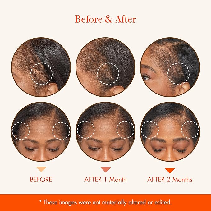 RED by Kiss Hair Growth Scalp Ampoule Growth MD Scalp Strengthening 10X Biotin and Rosemary Oil Infused, Made with 100% Natural Ingredients, USDA Certified Organic Oils, Non-GMO