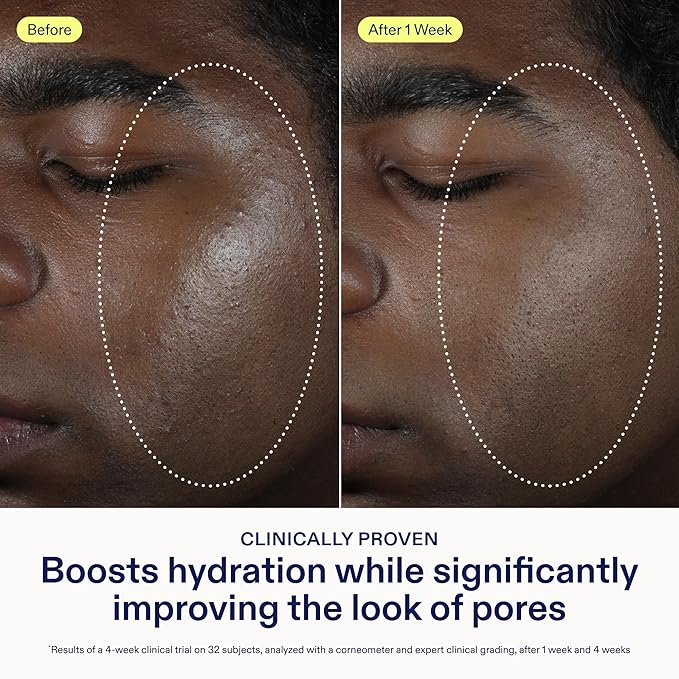 Skinfix Barrier Balancing Water Cream Mini - 0.5 oz - Weightless Moisturizer with Hyaluronic Acid & Niacinamide - Combo + Oily Skin - Acne-Safe, Non-Comedogenic, Fragrance Free, Vegan, Cruelty Free