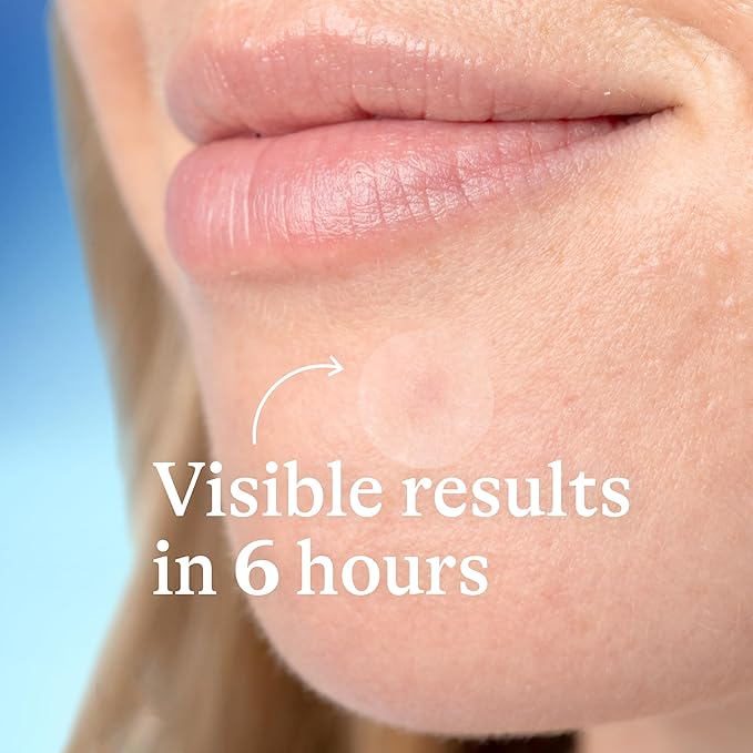Differin Acne Patches,Pimple Patches for Acne Prone Skin,Formulated with Salicylic Acid and Centella,Fast Triple Action Power Patch for Day & Night,Dermatologist Tested,36 Count (Pack of 12)