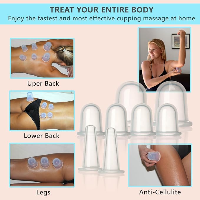 Cupping Kit for Massage Therapy - 8 Silicone Massage Cups for Arthritis Relief, Pain Reduction, Anti-Aging & Cellulite Treatment - Cupping Set (2XL, 4L, 2M)