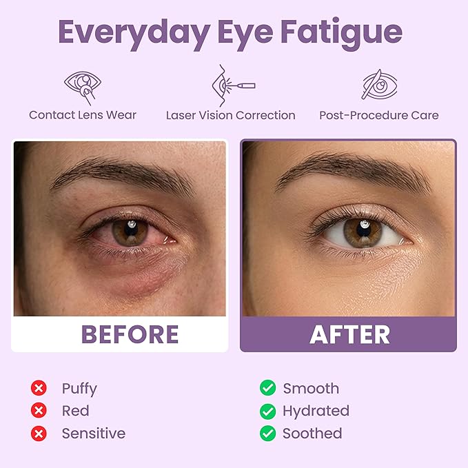 Eye Serenity Steam Eye Mask, Heated Eye Mask, Self Heating Warm Compress for Dry Eyes, Fast Relief for Stye, Puffy Sensitive Eyes, Moist Heat, Mothers Day Gifts for Women and Men - Lavender
