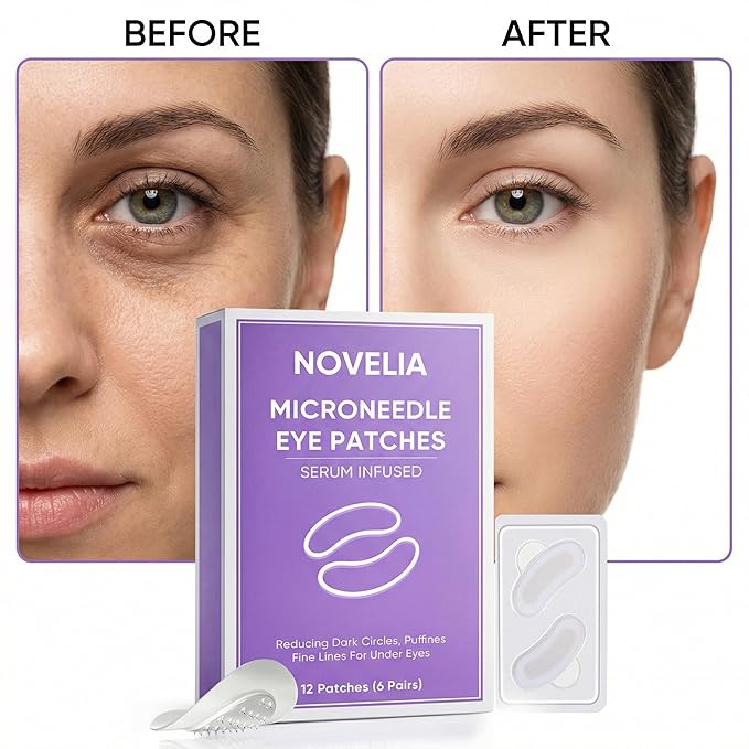 Novelia Micro Eye Patches, Microglow Undereye Patches, Hyaluronic Acid Serum Infused Eye Masks, Reduce Puffy and Dark Circles, Firming Smile Line, Hydrating & Smoothing Skin (6Pairs) (1 Box)