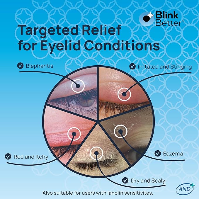 BlinkBetter Lanolin Free Eyelid Ointment 10g – For Sensitive & Dry Eyelids - Hydrates, Nourishes & Soothes – Moisturising Care for Dry, Itchy, Red, Sensitive, Flaky Skin Around the Eyes